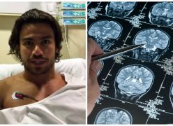 Visão Espírita - Há Males que Vêm para o Bem - (Cantor Mariano descobre tumor benigno do cérebro ao sofrer acidente em programa de televisão).