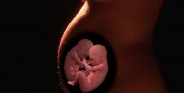 Bebês gêmeos abortados morreram abraçados!