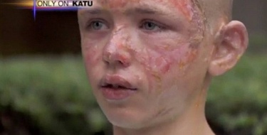 Todos zombavam dele por causa de sua cicatriz - Conheça a emocionante história deste menino (A Marca do Amor)